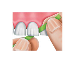 Matrizenband Softrix